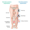 The symptoms of lymphoedema