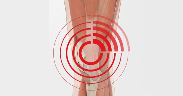 9 Essential Exercises for Patellofemoral Pain Syndrome - Physical