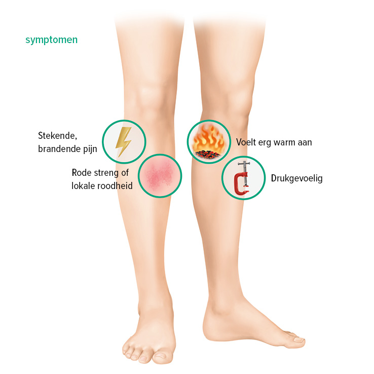 Symptomen oppervlakkige veneuze trombose Symptomen oppervlakkige veneuze trombose