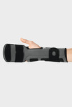 Right arm with Palmar Xtec Digitus wrist orthosis – view of palm