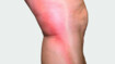 Beine mit rotem Strang auf der Seite