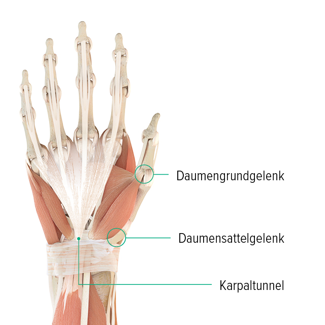 Anatomische Zeichnung - Rechte Hand, Sicht auf den Handrücken Anatomie-Grafik einer Hand: man erkennt dort das Daumengrundgelenk, Daumensattelgelenk und wo sich der Karpaltunnel befindet