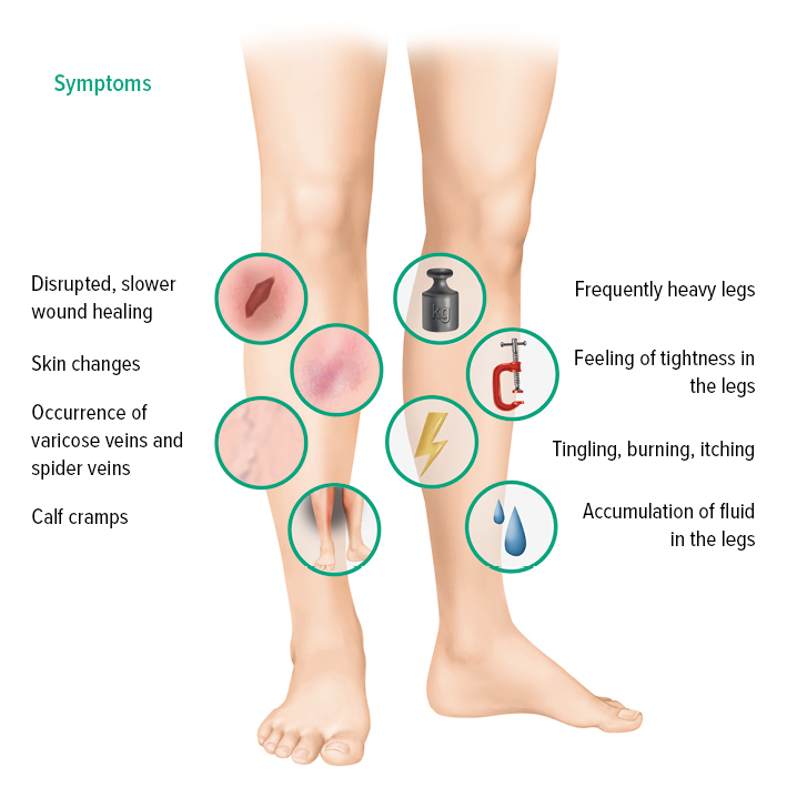 Symptoms CVI Symptoms CVI