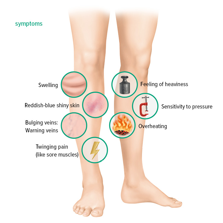 Thrombosis - Juzo