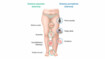 Sintomas do linfedema